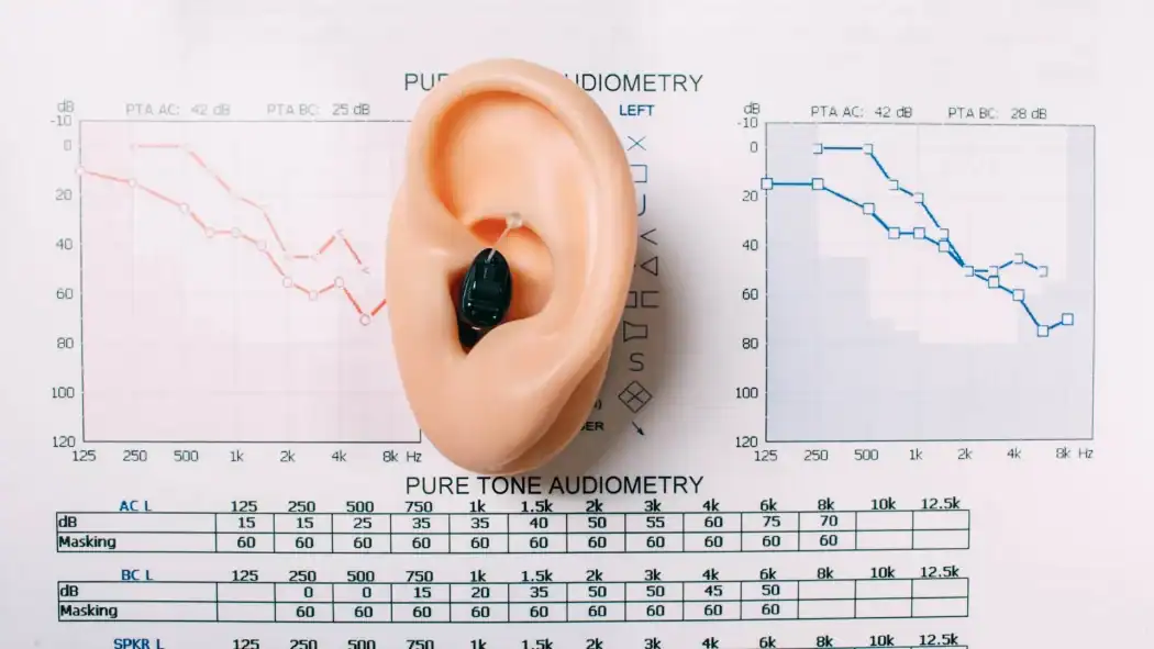 Hidden hearing loss can affect speech understanding even when hearing tests look normal. Learn how audiologists identify and manage this often-overlooked condition.